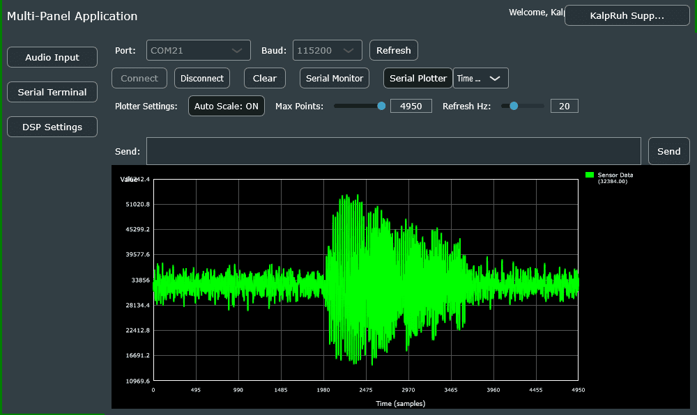 Signal Waveform Example